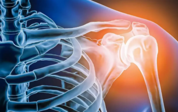 Osteoarticular